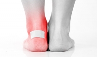What Can Cause Blisters?