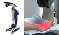 A Laser Treatment for Pain Relief