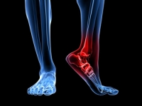 Issues That May Cause Heel Pain